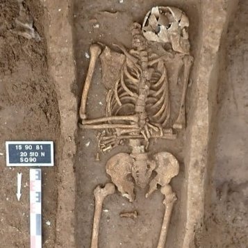 Unité de Taphonomie Médico-Légale & Anatomie tweet media