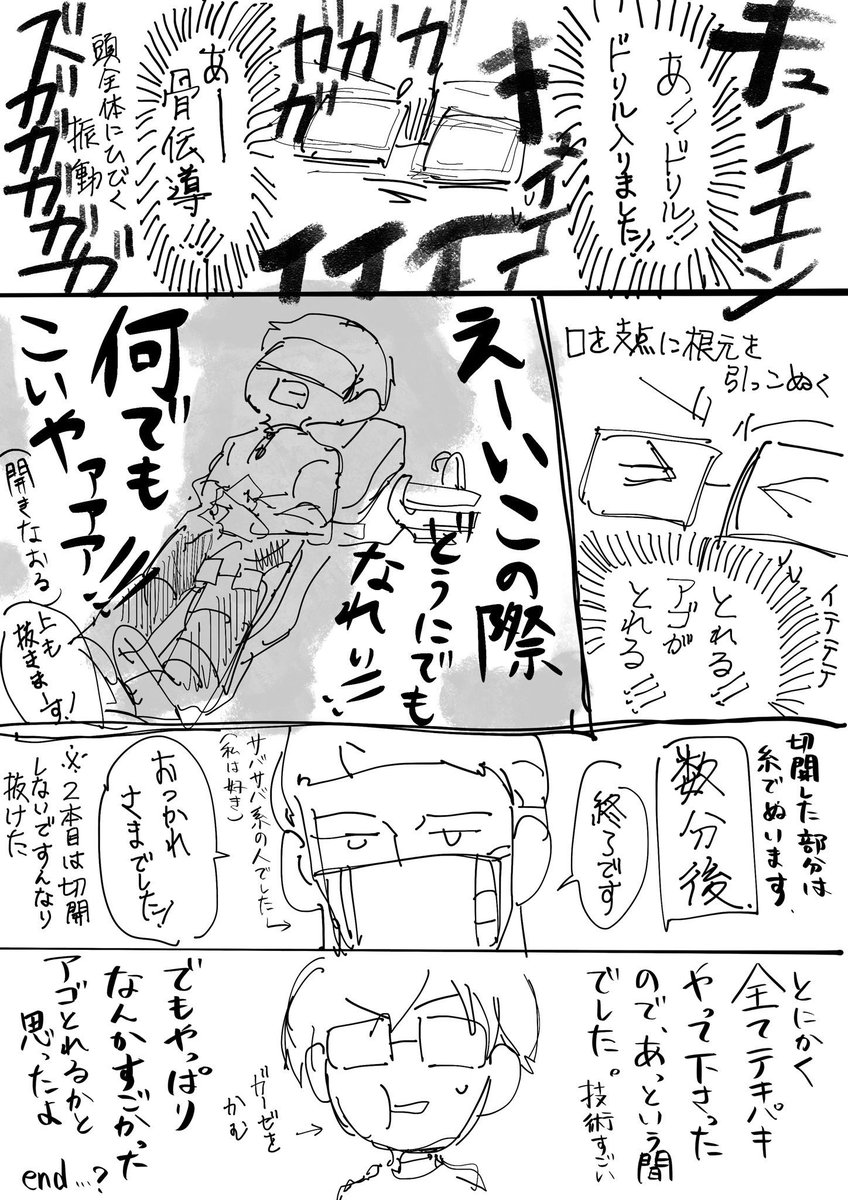 親知らず摘出レポ…(3年前) 