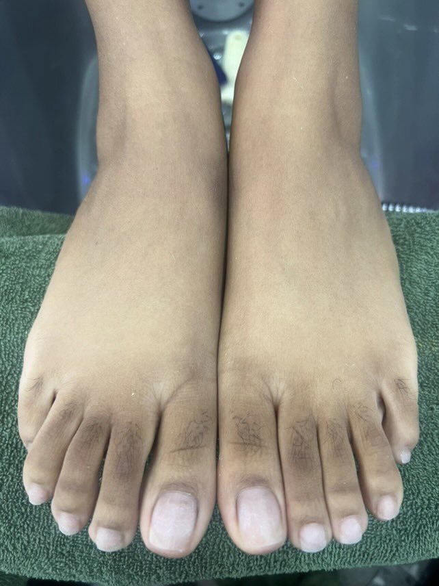 Natural_Nailss's tweet photo. Itโs hard to leave her when she got pretty toes ๐ฃ๐
.
.
.
#naturalnailfactory #longnailbeds #barenails #nopolish #unpolished #longnaturalnails #longnails #anonymoussender https://t.co/pQMpxT6dM0