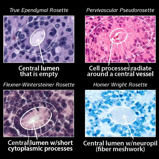 thejourneymate's tweet photo. Rosettes and Pseudorosettes : In Pictures 🔬🌸
https://t.co/AwuCSY9HCo https://t.co/so1RtSWb2w