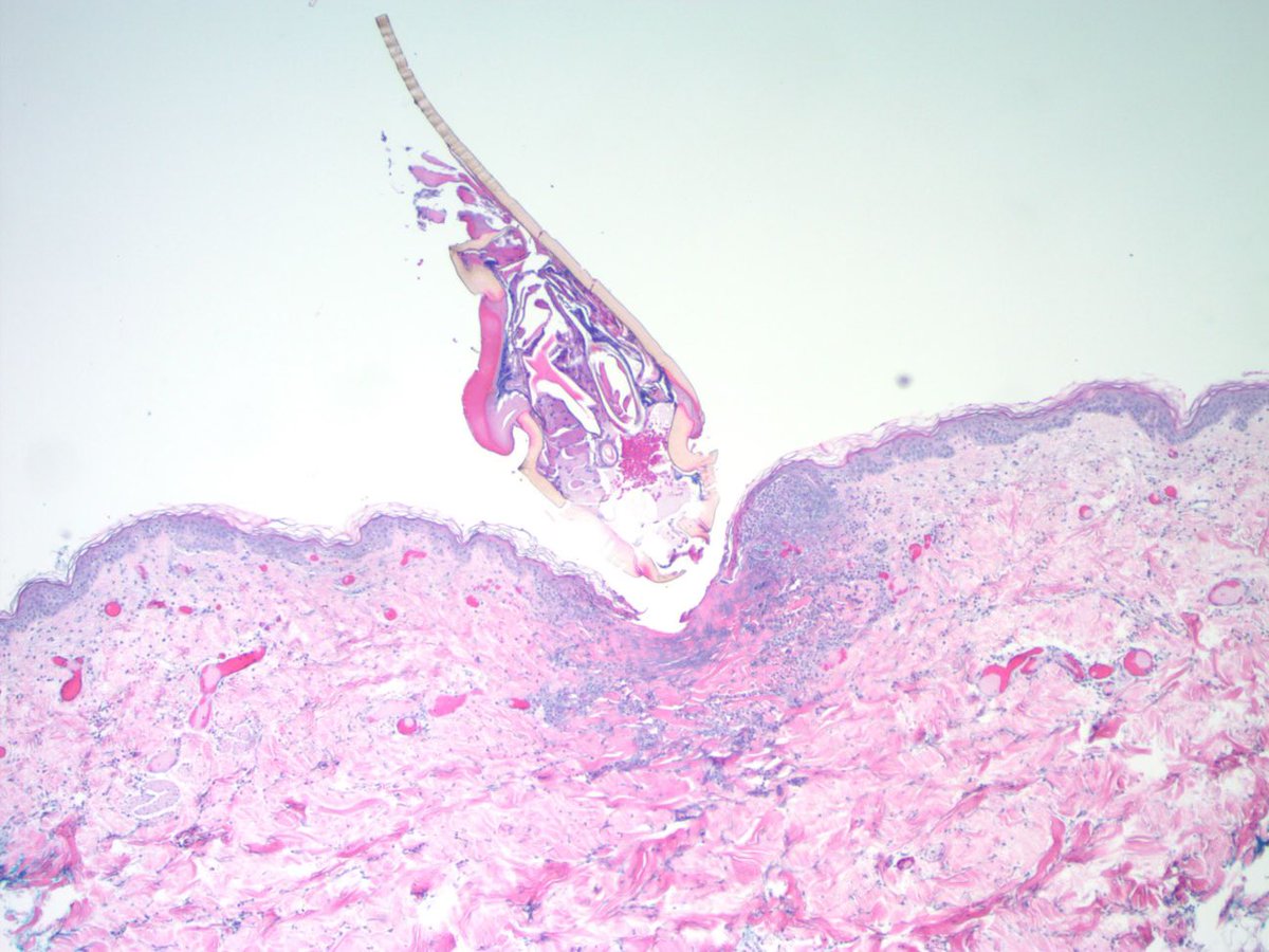 Medical Laboratory Education of Maine tweet media