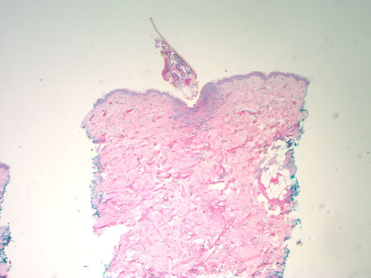 Medical Laboratory Education of Maine tweet media