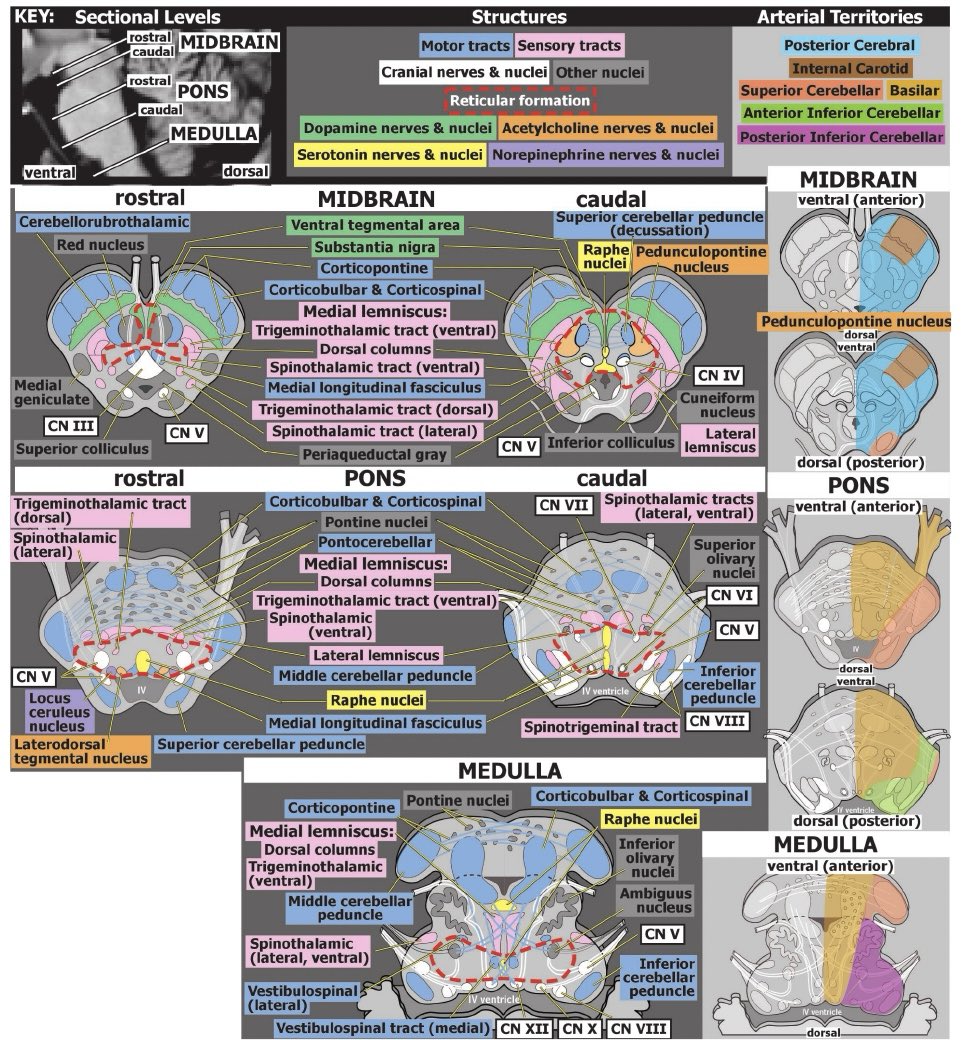 OGdukeneurosurg's tweet photo. Brainstem anatomy https://t.co/2qbyDJFHCI