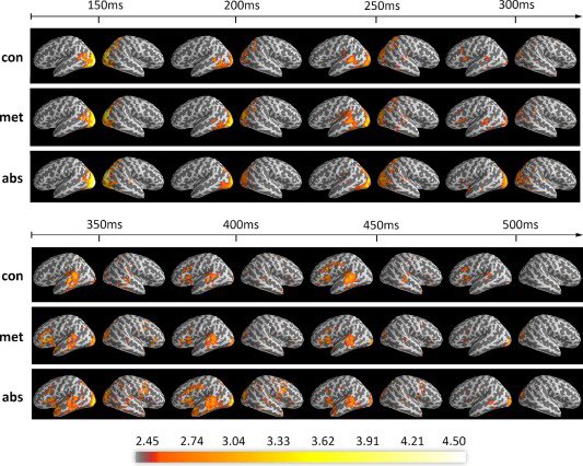Access to conceptual info in the #brain follows distinct pathway depending on level of abstractness. Most enjoyable work w <a href="/LiliTian06/">Lili Tian</a> <a href="/jjkujala/">Jan Kujala</a> &amp; Chen <a href="/JKLBrainMind/">Jyväskylä Brain & Mind</a> <a href="/uniofjyvaskyla/">University of Jyväskylä</a> 

Also good example of the power of MEG in studying 🧠 basis of language.

sciencedirect.com/science/articl…