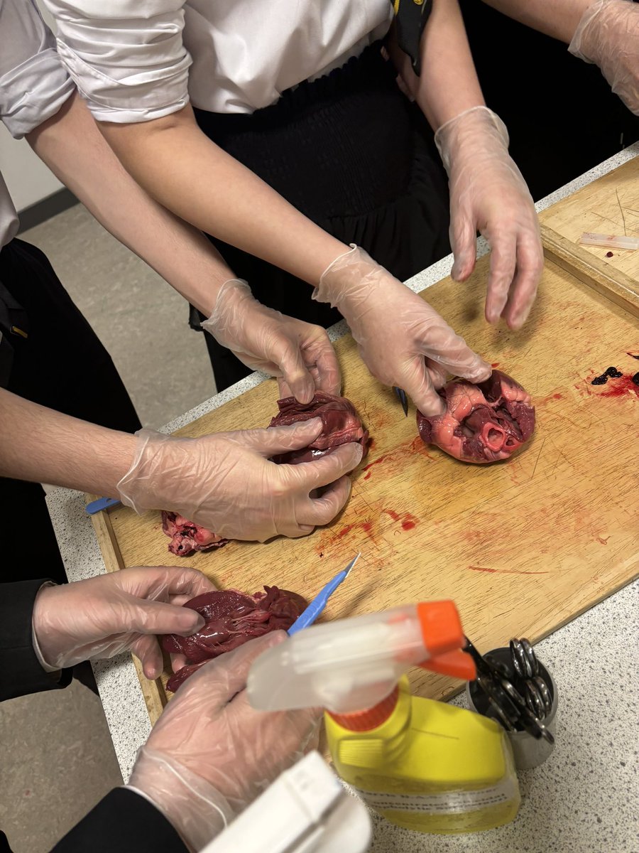 Miss McColm (@miss_mccolm) on Twitter photo Our Higher Human Biologists looking at the structure of the heart, locating the atrioventricular and semi lunar valves. Added bonus discovering blood clots which we linked to CVD <a href="/StMattsScience/">St Matthew's Science</a> Our Higher Human Biologists looking at the structure of the heart, locating the atrioventricular and semi lunar valves. Added bonus discovering blood clots which we linked to CVD <a href="/StMattsScience/">St Matthew's Science</a>