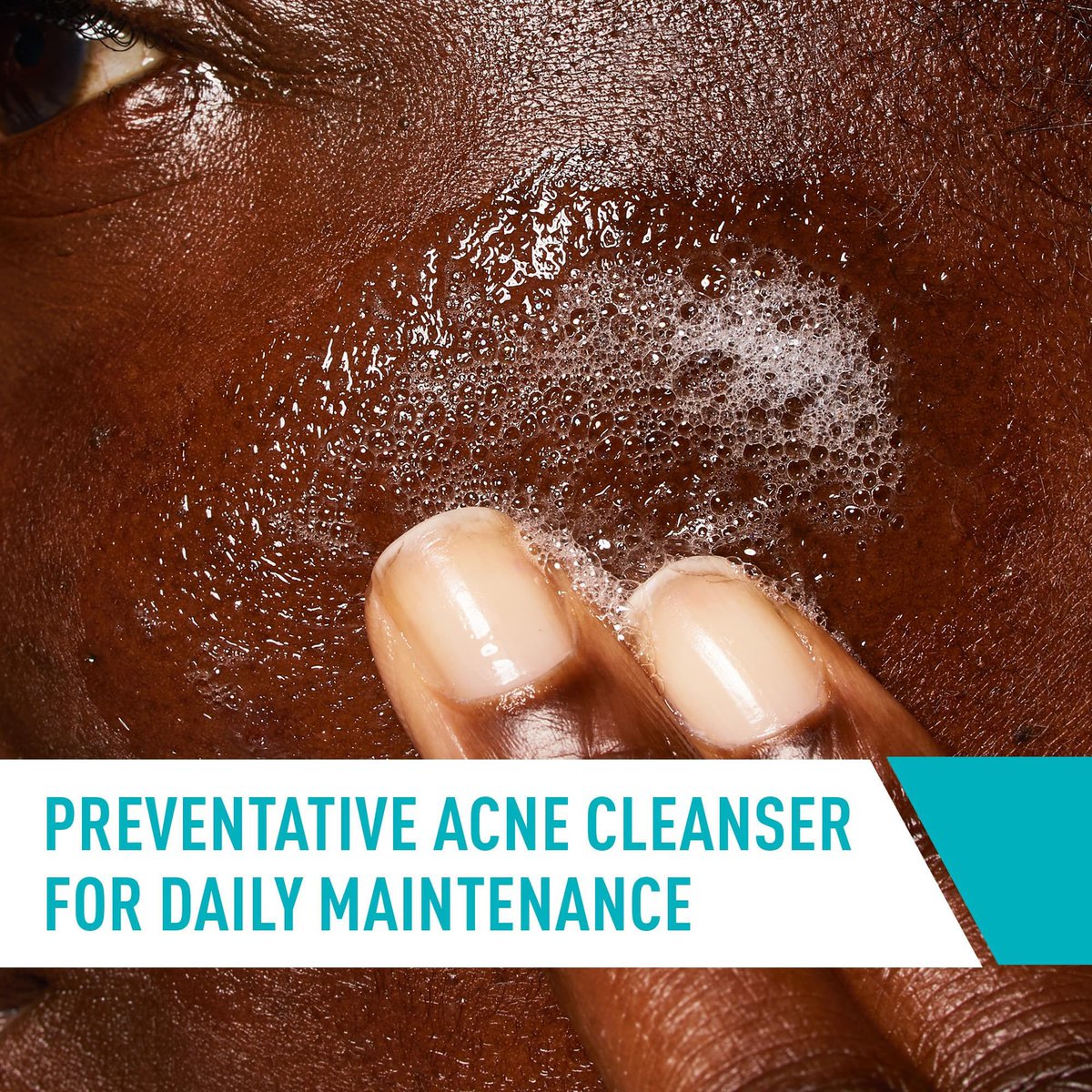 MNiceties's tweet photo. 🌟 CERAVE ACNE CONTROL CLEANSER 
CeraVe's salicylic acid cleanser is an effective way to treat and prevent acne. It unclogs pores and removes oil without irritating the skin.

🌟PRICE: 120k
🌟SIZE: 237ml
📱Call/ WhatsApp 0755232119 to order.
✨FREE DELIVERY FOR ORDERS ABOVE 100k. https://t.co/hJmtpJJpTp