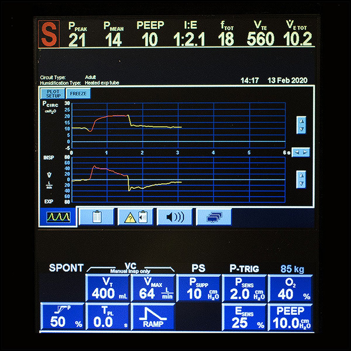 In a large animal model of left ventricular cardiogenic shock, researchers investigated the cardiovascular effects of increasing positive end-expiratory pressure. Read the new study: ow.ly/JkK050UlRNQ