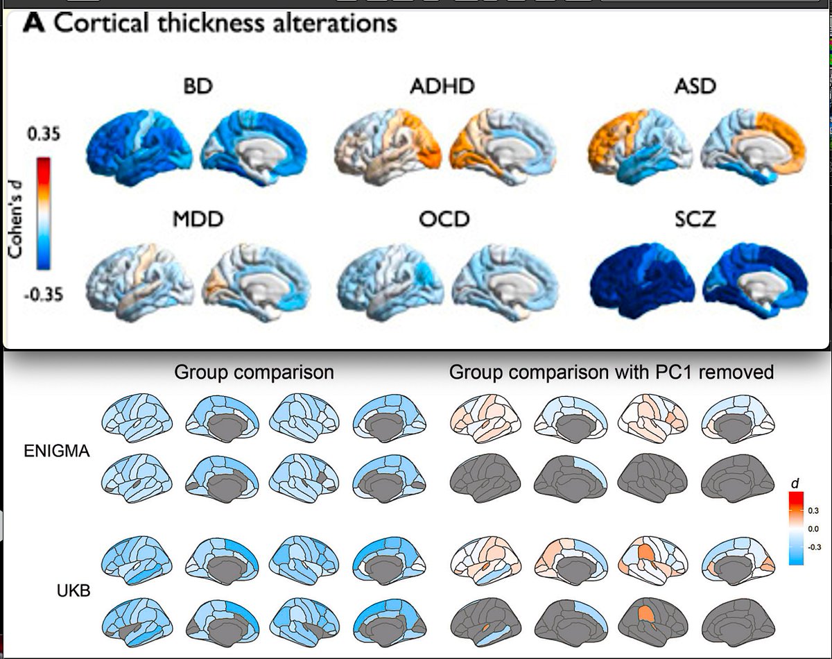 PTenigma's tweet image. Today&apos;s ENIGMA Summit compared over 20 brain disorders in tens of thousands of people scanned with MRI, and suggests that:
1. brain disorders that hit very early, before birth (e.g. those due to genomic copy number variants such as genetic deletions) tend to affect cortical…