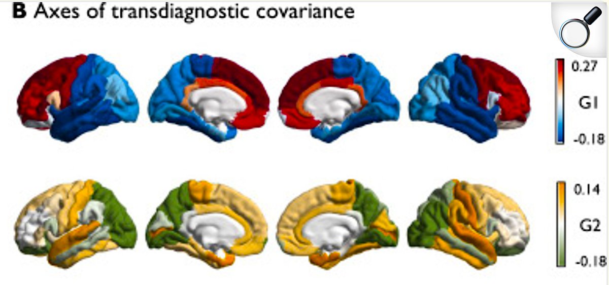 PTenigma's tweet image. Today&apos;s ENIGMA Summit compared over 20 brain disorders in tens of thousands of people scanned with MRI, and suggests that:
1. brain disorders that hit very early, before birth (e.g. those due to genomic copy number variants such as genetic deletions) tend to affect cortical…