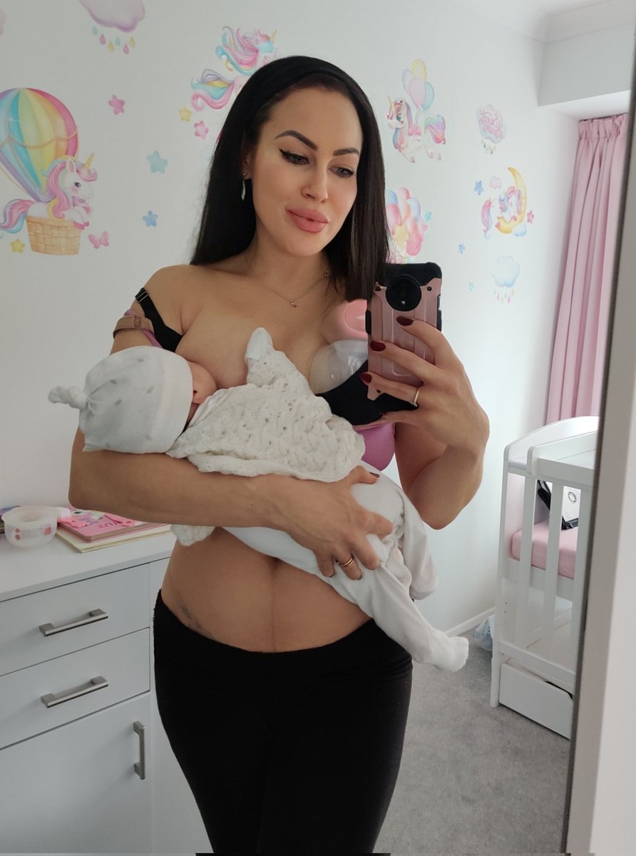KataxennaKova's tweet photo. ONE month since giving birth to my beautiful baby girl 💞 + still recovering from my emergency c-section

Full post, info + photos at 👇
https://t.co/6OQFW49BFP ✨

#csectionrecovery  #csectionfitness #postpartum #postnatalfitness #csectiontips #cesarean #kataxenna #kataxennakova https://t.co/PEd3DdmMtB