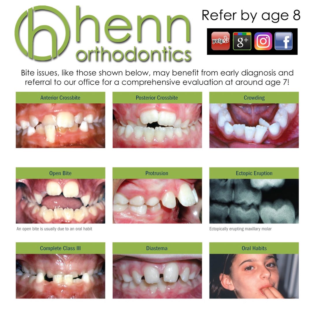 HennOrtho's tweet photo. Get your little one in for a free consultation around age 8!  No referral needed!  Call or text us direct at 502-935-7212 or 812-302-6802! https://t.co/oAXeycXQGg