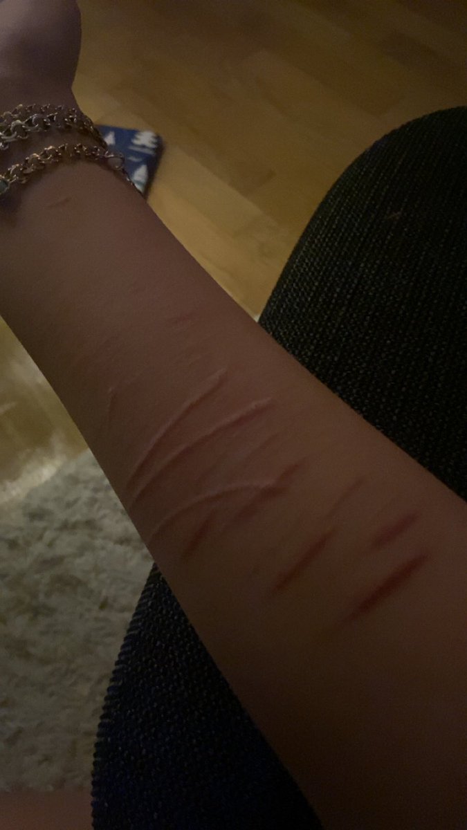 emilianutsack's tweet photo. my kitty scratched my arm, reminding me of good ol’ times 😭🙏 https://t.co/8rSMFMKRIe