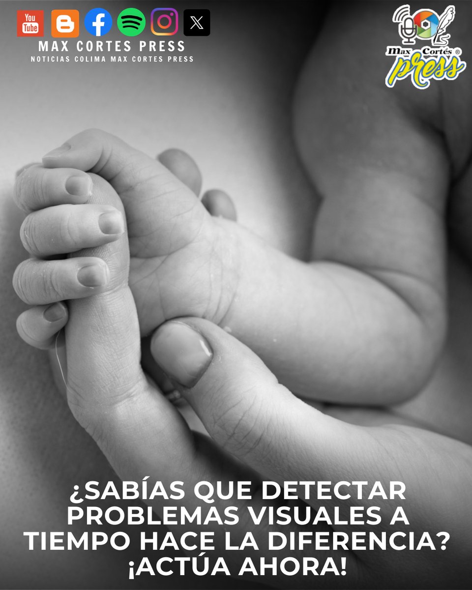 maxcortespress's tweet image. #RecienNacidos | 𝐓𝐨𝐝𝐨𝐬 𝐥𝐨𝐬 #niños 𝐚𝐥 𝐧𝐚𝐜𝐞𝐫 𝐝𝐞𝐛𝐞𝐧 𝐬𝐞𝐫 𝐫𝐞𝐯𝐢𝐬𝐚𝐝𝐨𝐬 𝐩𝐨𝐫 𝐮𝐧 #oftalmólogo: 𝐃𝐫. 𝐀𝐦𝐞𝐳𝐜𝐮𝐚
✅   Escucha la entrevista aquí: 👇
maxcortespress.com.mx/2024/12/todos-…
#Colima #MaxCortesPress #noticias #lamejorfm #fyp #parati #LBN