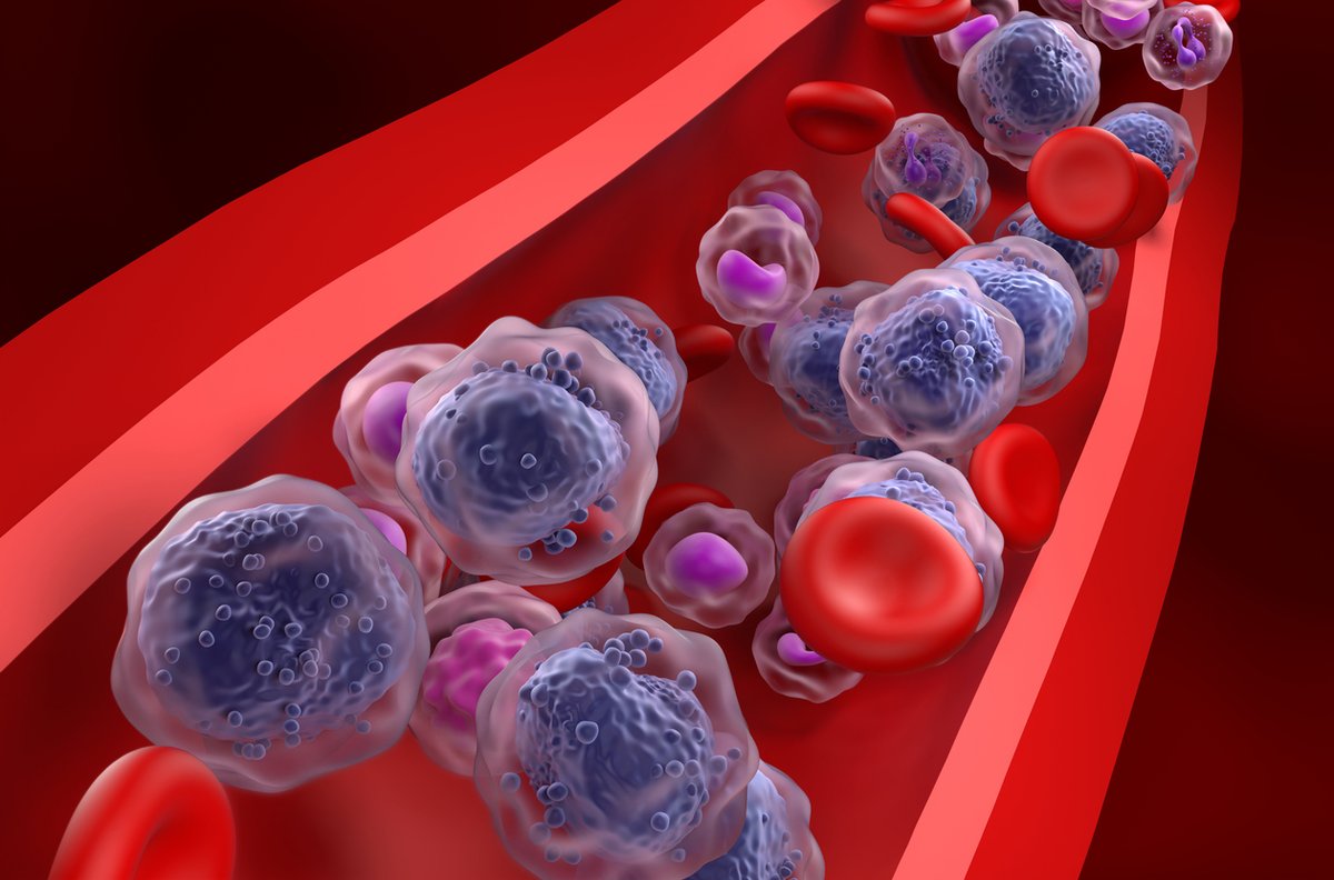 UC San Diego Health Sciences (@ucsdhealthsci) on Twitter photo Out now in <a href="/naturemethods/">Nature Methods</a>: First comprehensive map of the dramatic changes that take place in the blood system over the course of the human lifetime could have implications for the treatment of acute myeloid leukemia and other blood diseases. Read more: go.ucsd.edu/4imQZxm Out now in <a href="/naturemethods/">Nature Methods</a>: First comprehensive map of the dramatic changes that take place in the blood system over the course of the human lifetime could have implications for the treatment of acute myeloid leukemia and other blood diseases. Read more: go.ucsd.edu/4imQZxm
