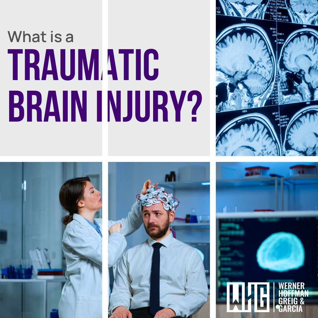 whglaw's tweet photo. A #TraumaticBrainInjury (#TBI) occurs when sudden force causes damage to the #brain. This damage can cause mild, moderate, severe, or even deadly repercussions. If you’ve suffered a TBI due to negligence, #WHG is here to help. 📞 Don’t let a TBI define your future—call us today. https://t.co/ZLeHWnxZlC