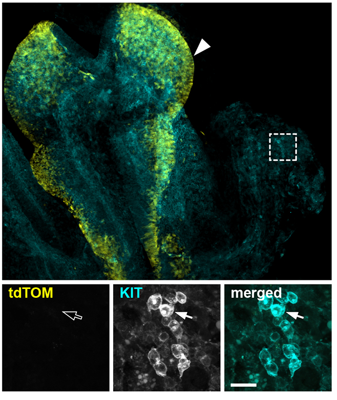Hematopoiesis News (@hema_news) on Twitter photo Led by Drs. <a href="/Gio_Canu/">Giovanni Canu</a> and Christiana Ruhrberg (<a href="/RuhrbergLab/">Ruhrberg lab</a>), this <a href="/Dev_journal/">Development</a> study shows that the mouse fetal liver and circulation contains a transient population of Pax3 lineage cells with the potential to generate myeloid and erythroid cells.
🔗 bit.ly/4gpajZb Led by Drs. <a href="/Gio_Canu/">Giovanni Canu</a> and Christiana Ruhrberg (<a href="/RuhrbergLab/">Ruhrberg lab</a>), this <a href="/Dev_journal/">Development</a> study shows that the mouse fetal liver and circulation contains a transient population of Pax3 lineage cells with the potential to generate myeloid and erythroid cells.
🔗 bit.ly/4gpajZb