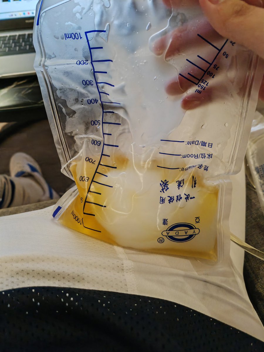 把精子润滑液倒进尿袋再挤进膀胱……#导尿 #膀胱 #足球鞋