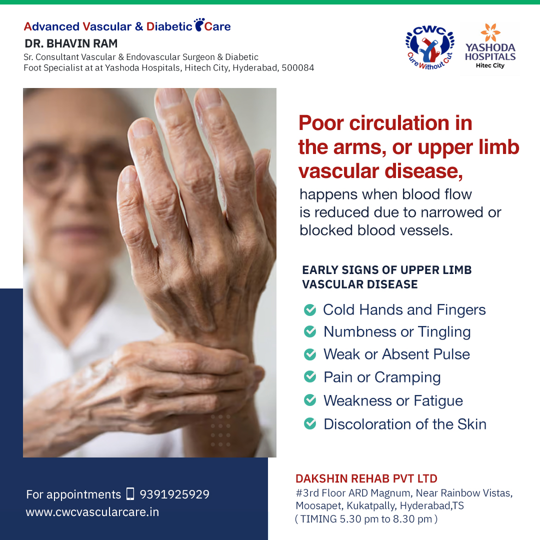 DrBhavinRam1's tweet image. Experiencing cold hands or numbness? These may be early signs of upper limb vascular disease. Don’t ignore the warning signs—act early to protect your vascular health!
bit.ly/3hfmJdi
#Poorbloodcirculation #numbness #upperlimbvasculardisease #vasculardisease @drbhavinram