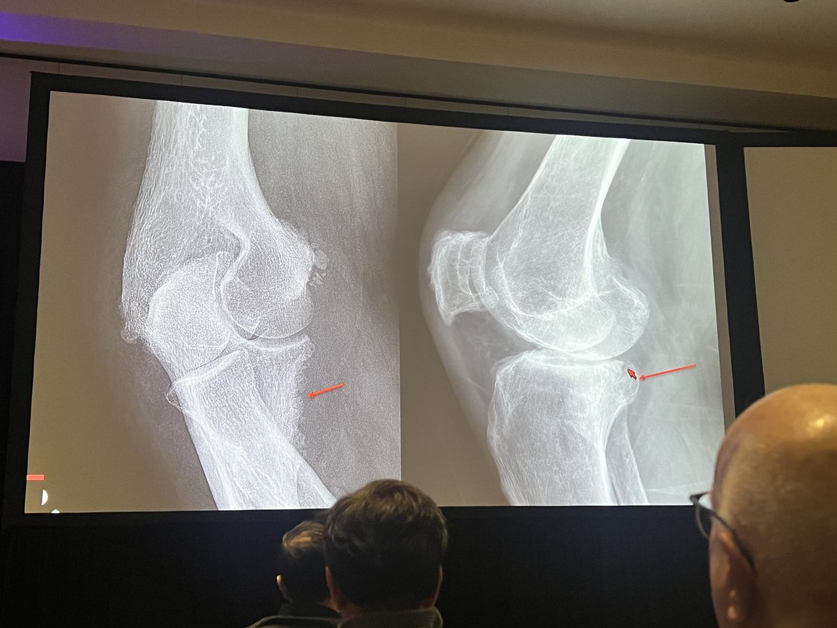 Thank you for the engaging and informative presentation on the signs to not miss in inflammatory arthritis! #RSNA2024