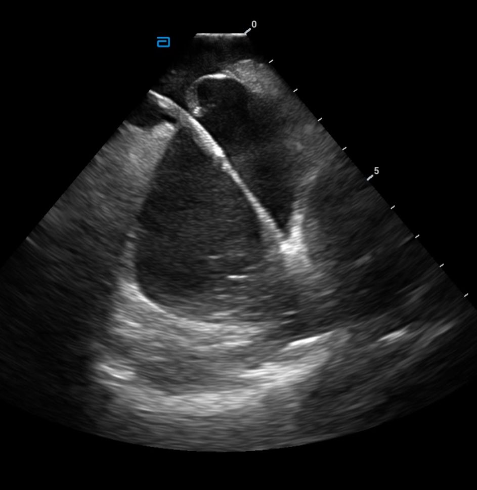 drluissaenz's tweet photo. @rafaelhisaac @fcardioinfantil @carlostapiasMD @stlunap @Edgar74774288 @william_Bauti @stalvinder Honored to host the #Abbott #IEPC AF LATAM course at @fcardioinfantil . 2 days of live cases and presentations by our EP team.  Proud of them !! https://t.co/OE3Jt6djDQ