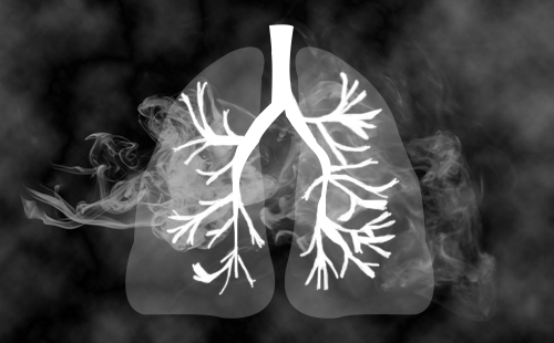 JNOjournal's tweet photo. GLIM-defined malnutrition is strongly linked to shorter survival in lung cancer patients, highlighting the importance of nutritional assessment.
#malnutrition #cancer #oncology
@JNOjournal 
https://t.co/cJK1ibP1tj https://t.co/Bp7rAhRSLq