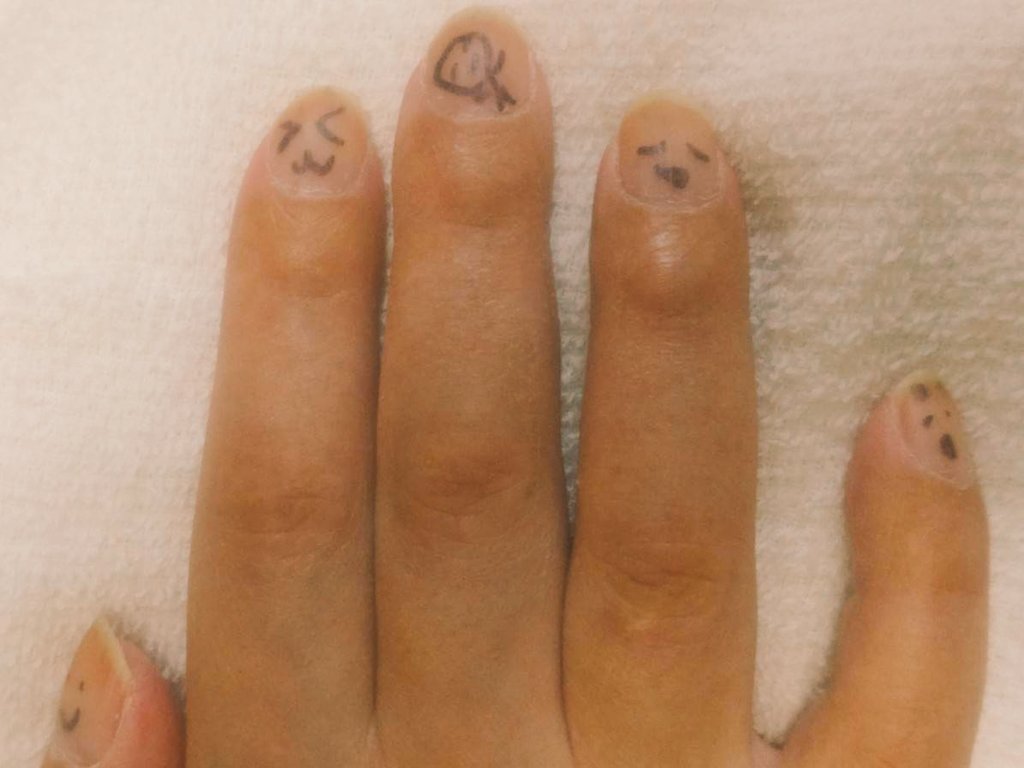 otani_shinjiro's tweet photo. 「パパ、書くね!」
ペンを持った娘がそう言うと
僕の手を掴み、何やら作業を開始する
時間にして約20秒後
僕の爪には様々な顔が描かれていた
その描かれた顔を眺めているだけで元気が湧いてくる(* ´ ▽ ` *)
愛おしくてたまらない
#押忍REMIUM #pwzero1 #栃木プロレス #GanPro #ホットジャパン #何度でも立ち上がれ