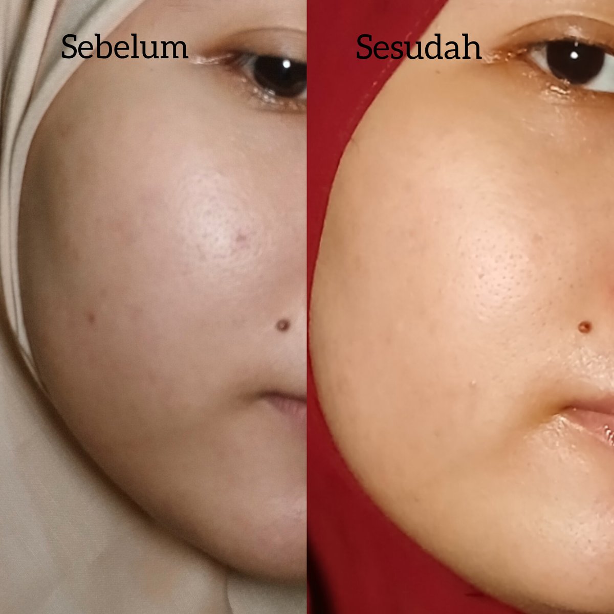 amel_nufus's tweet photo. Siapa yang lagi struggle sama bekas jerawat dan flek hitam❓️❓️ Sini sini merapat, karna @AzarineCosmetic baru aja launching Glow Revolution Series. Produk yang aku coba face wash dan moisturizernya. #AzarineGlowRevo https://t.co/kffqtv6zIa