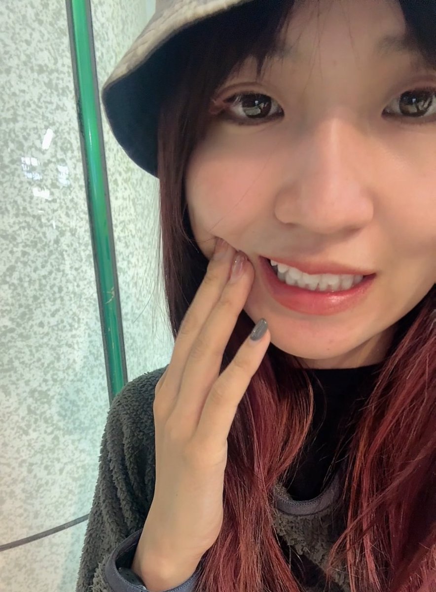 いまから歯を2本抜いてくる…🦷 応援してヽ(´Д`;≡;´Д`)丿
