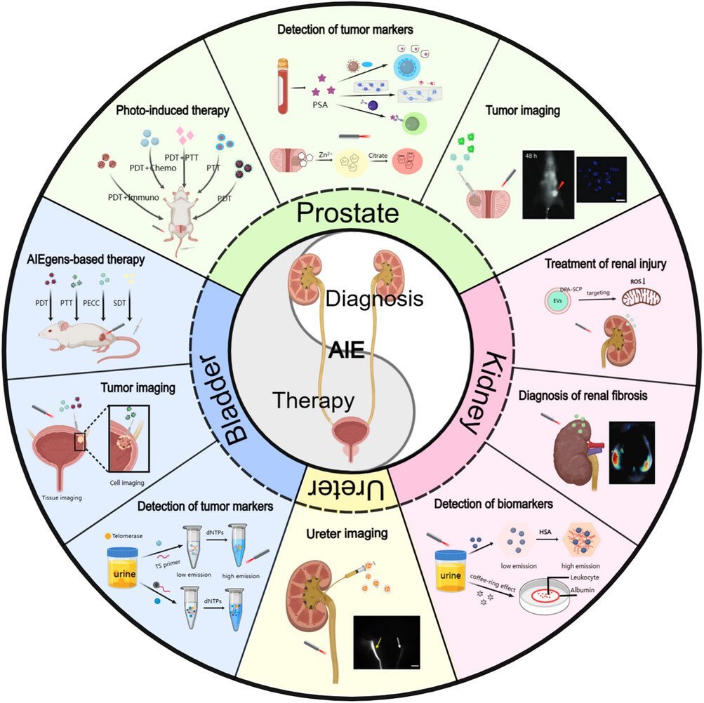 AggregateOA's tweet photo. New Review📖
"Utilization of aggregation-induced emission materials in #urinary system #diseases"by He Wang & Xuedong Wei et al. @WileyBiomedical #AIE #prostate #kidney #bladder #ureter
Check👉https://t.co/jrP0xldQE5 https://t.co/AFciZm8ogb