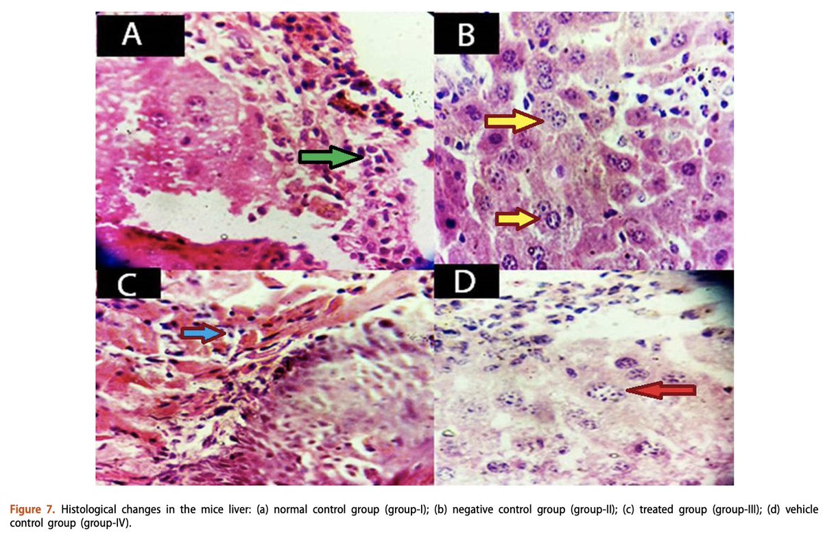DDIPJournal's tweet photo. π¬ New Research Alert! π Liposomal delivery of Annona muricata leaves extract for the treatment of hepatocellular carcinoma π
Published in #DDIPJournal
πRead the full article here: https://t.co/AVDQTjWdws https://t.co/nI0zKKX5Ol