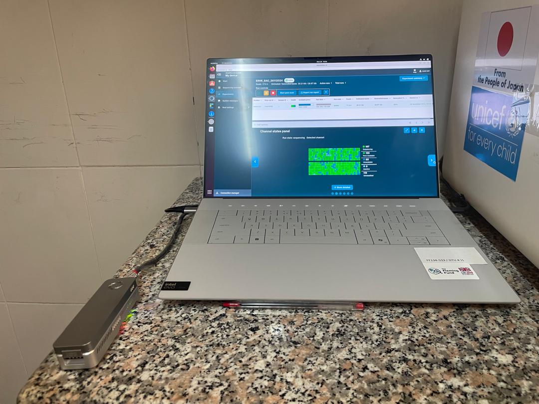 NMIMR_AMRHub's tweet photo. A successful ONT sequencing training was held at Eastern Regional Hospital. This initiative built local capacity, equipping the team with the skills to sequence independently. Strengthening expertise for sustainable solutions! 🧬 #AMR #Seqafrica #CapacityBuilding #Genomics https://t.co/jAL2pERovS