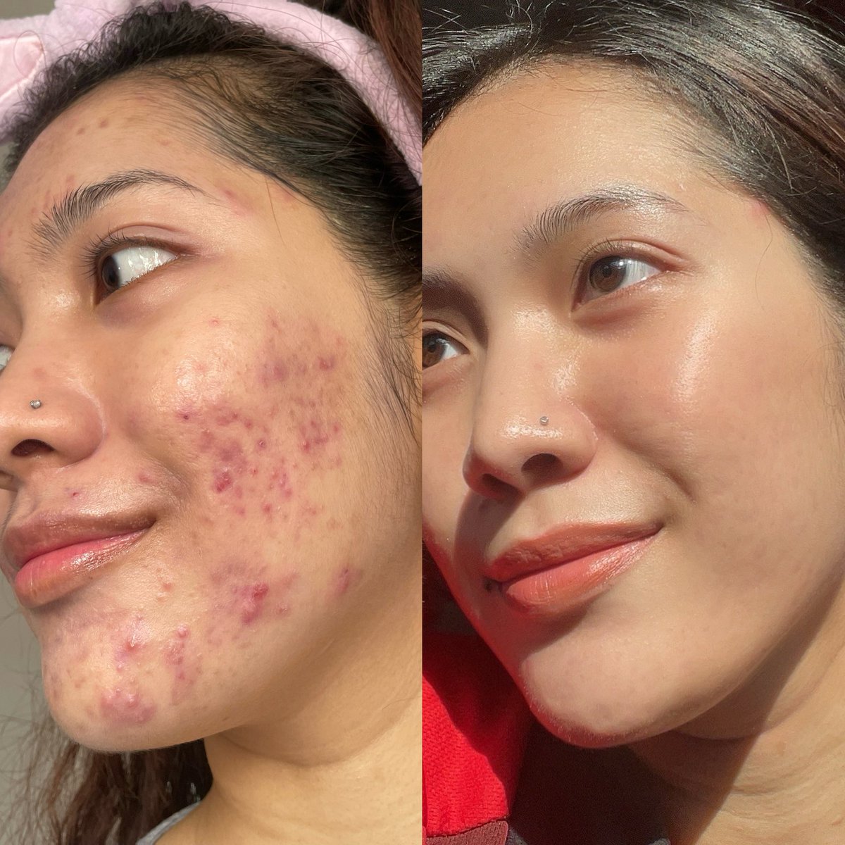yanaazmill's tweet photo. Products that I've tried this year, and it helped me to ✨glow up✨

1. Probiotics
2. Cranberry juice 

Ladies, dua-dua ni elok kalau you nak improve skin and vaginal health!! https://t.co/glFHLjT6pP
