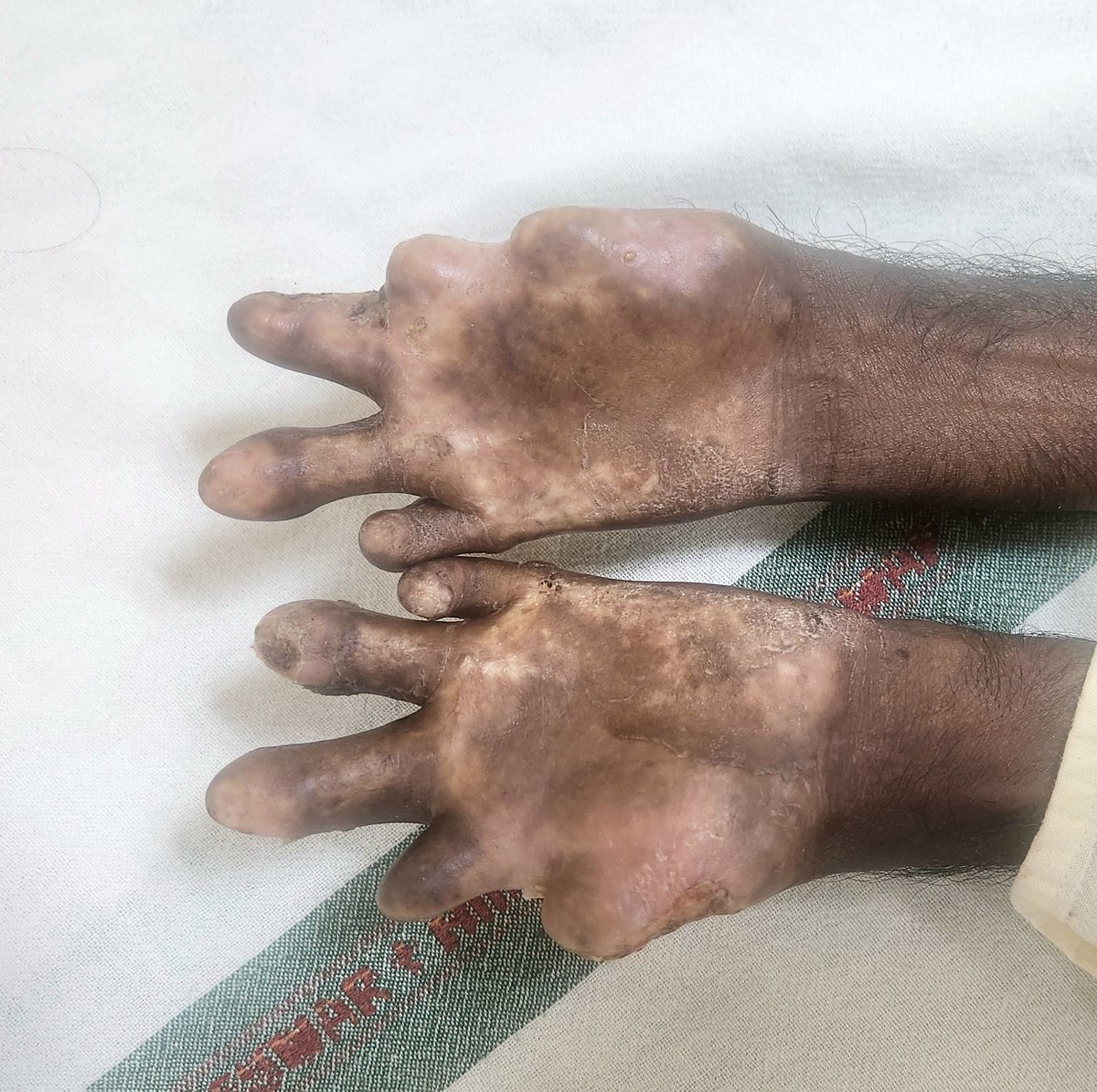 Dr Priti MD,FASN🇮🇳 (प्रिति) tweet media