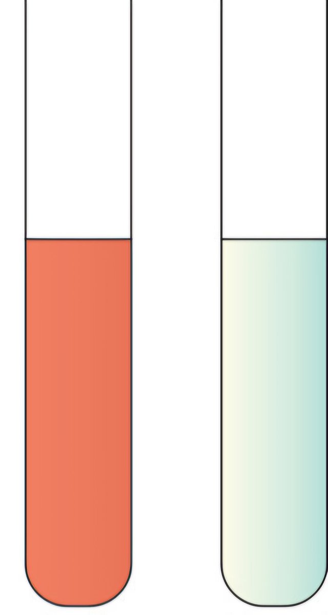 Dr Priti MD,FASN🇮🇳 (प्रिति) tweet media