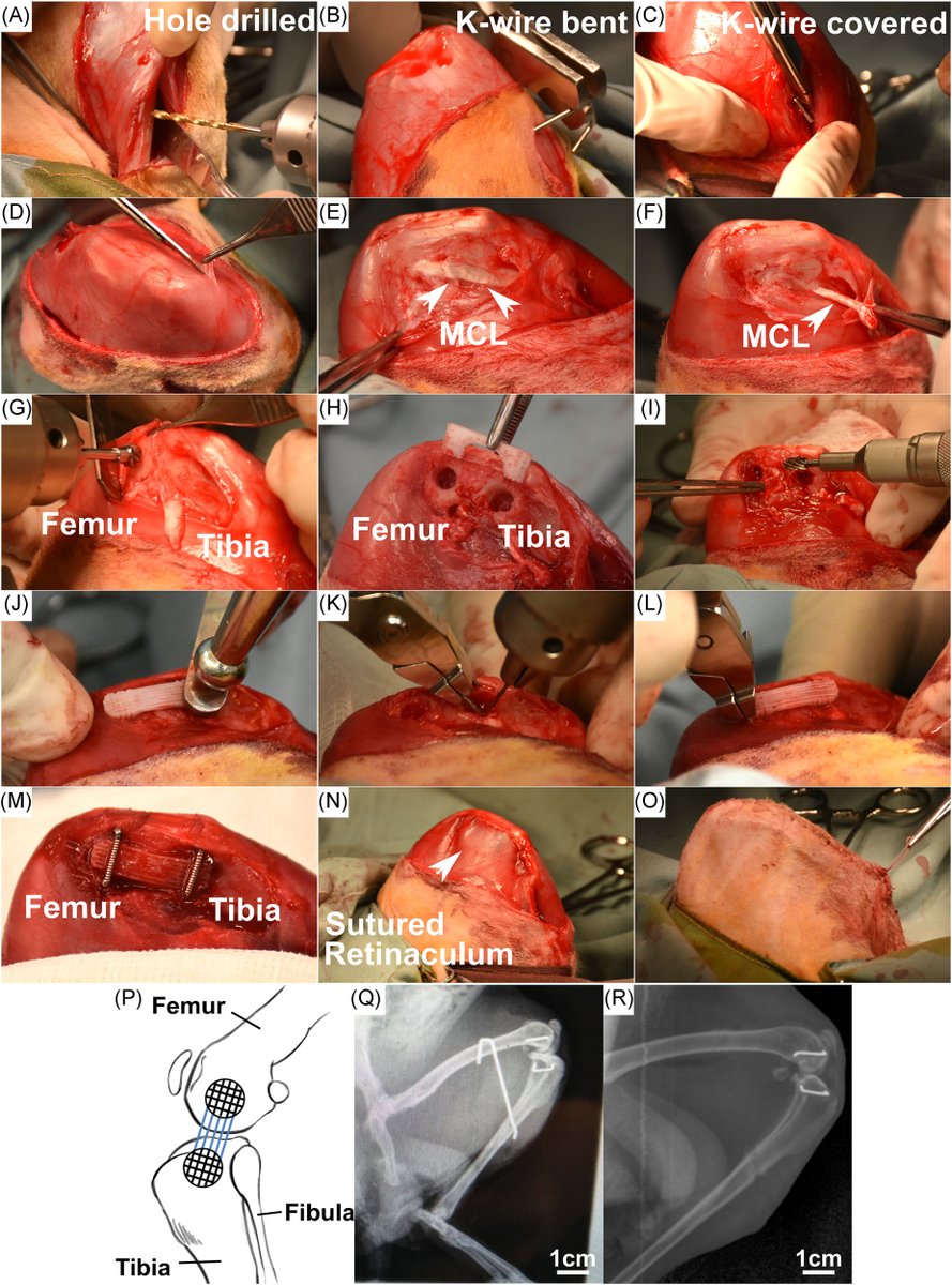 Ausilah Alfraihat, PhD (@ausialfraihat) on Twitter photo Can 3D printing revolutionize ligament repair? This study <a href="/JOrthopRes/">Journal of Orthopaedic Research®</a> shows how a multiphasic scaffold could regenerate bone and ligament tissues, offering new hope for scapholunate injury treatment. #ORSSML <a href="/ORSSociety/">Orthopaedic Research Society</a>
Read more: bit.ly/4gonUA2 Can 3D printing revolutionize ligament repair? This study <a href="/JOrthopRes/">Journal of Orthopaedic Research®</a> shows how a multiphasic scaffold could regenerate bone and ligament tissues, offering new hope for scapholunate injury treatment. #ORSSML <a href="/ORSSociety/">Orthopaedic Research Society</a>
Read more: bit.ly/4gonUA2