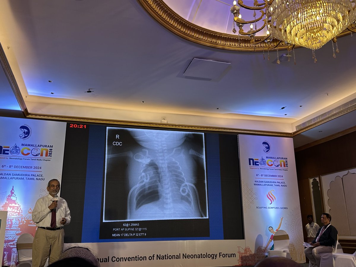 neosatyan's tweet photo. Being Sherlock Holmes - an engaging talk on neonatal diagnostic errors by ⁦@Dr_KSGautham⁩ at #NEOCON2024 moderated by Dr. Manikoth. Can you identify a subtle finding that was initially missed on the X-ray below? https://t.co/sgQWJkBsnB