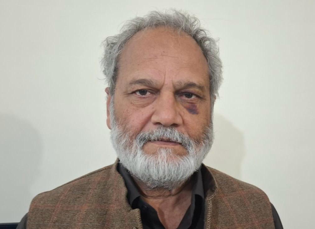 ہمارے ساتھئ MNA عمران خان کے سپاہی عظیم الدین لکھوی صاحب کو 10 دن کے بعد رہا کر دیا گیا ہے ان کے ساتھ جو سلوک کیا گیا ہے وہ ان کے چہرے سے ایاں ہیں نہ ہی اس حکومت کو شرم اتی ہے نہ اس کو کوئی حیا اتی ہے