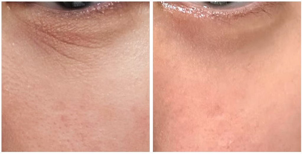 𝑨𝑶Ⓒ tweet media