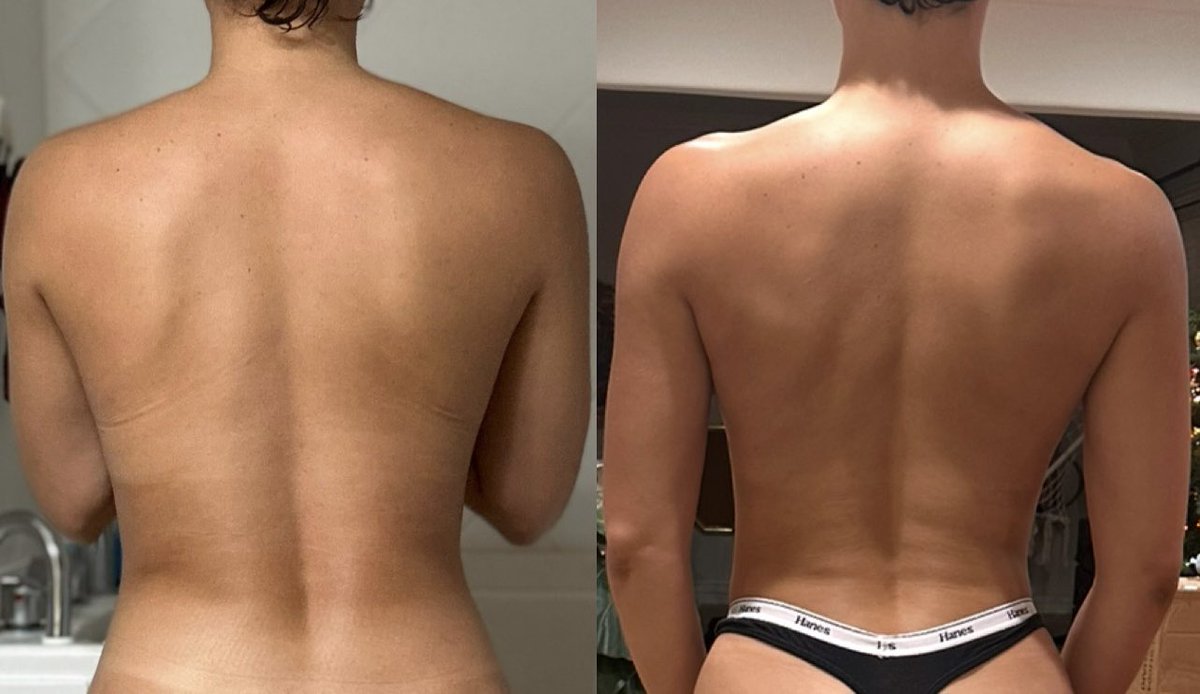 anwanfw's tweet photo. I sent my mom my progress pics and she, “Okay…. Back is looking kinda strong…. May not need much more work in it”
🤣🤣

Whole time I’m still on Level One 😅 https://t.co/yvGKAyHKSP
