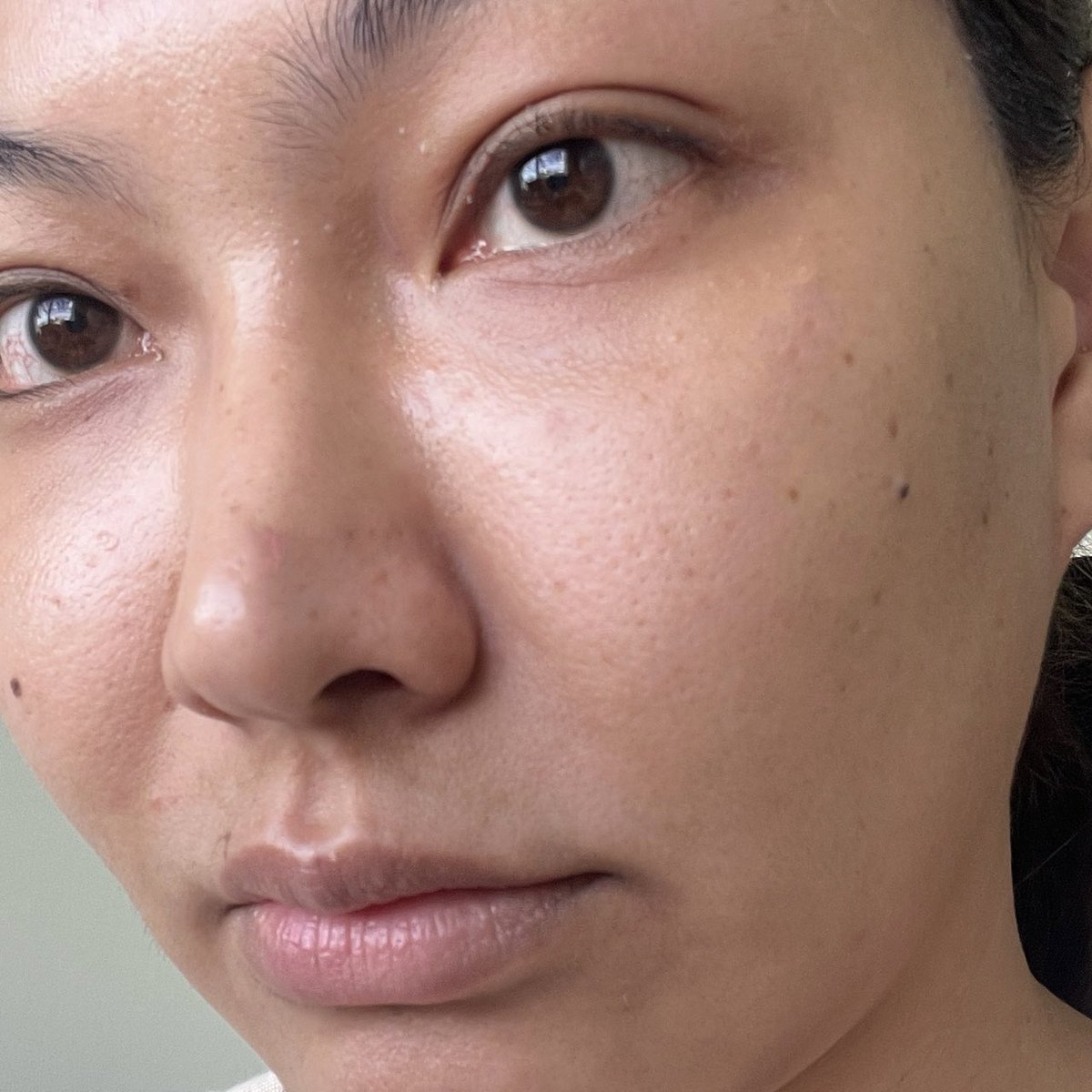 La Roche-Posay ไม่มาเล่นๆฮะ ก่อนออกงานที่ต้องใช้หน้าคือคุณสิวจะมารู้เวลาตลอด บิวได้ Effaclar Duo+M สูตรใหม่มาลองพอดี ใช้ก่อนนอน 8 ชั่วโมง ตื่นมาสิวก็เริ่มแห้งละฮับ คือเค้ารีเสิร์ชมาแล้วว่าการเสียสมดุลของแบคทีเรีย C.Acnes( 1A1) ซึ่งเป็นตัวก่อให้เกิดสิว ตัวนี้มี Phylobioma ช่วยจัดเรื่องสิว ปรับสมดุลแบคทีเรียบนผิว ลดความมันส่วนเกิน เนื้อสัมผัสดี ซึมไว ใช้แล้วสิวดูจางลง ผิวเรียบเนียนขึ้น สูตรนี้รอยแดงยุบไวกว่าสูตรเดิมด้วย แนะนำงับ 
หาซื้อได้ตาม WATSONS, BOOTS, EVEANDBOY, BEAUTRIUM, LAZADA, SHOPEE, KONVY, CENTRAL ONLINE เลยค่ะ
#LaRochePosayTH