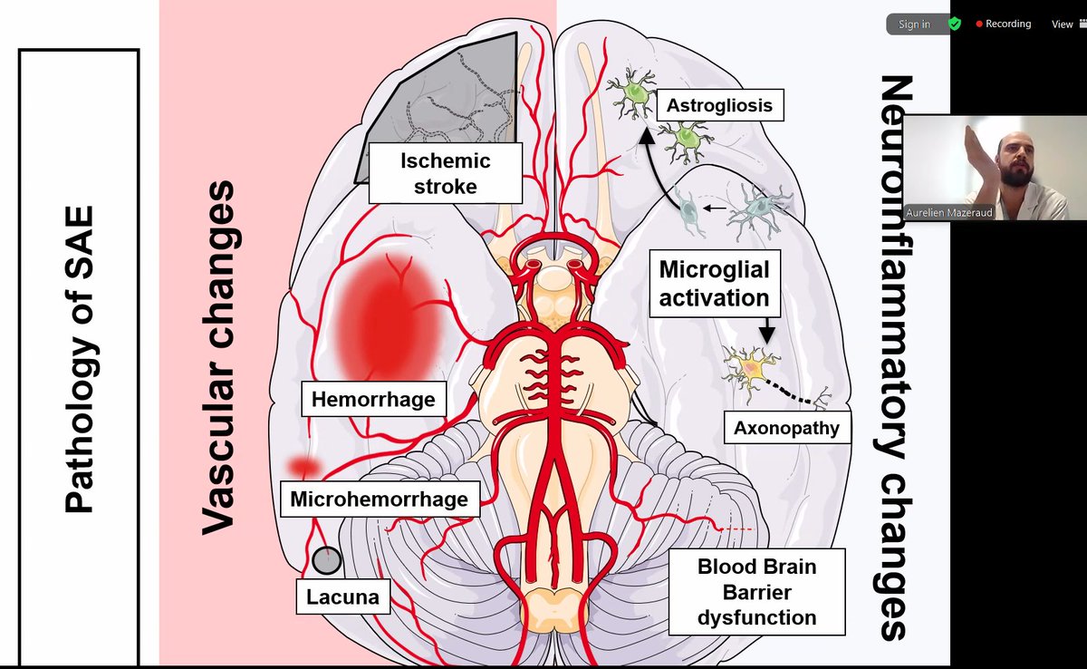 Terrific translational overview of the pathogenesis behind sepsis-associated encephalopathy - by Assistant Professor Aurelién Mazeraud 🧬
Interesting preclinical and clinical studies conducted by Aurelién and his group in modulating fear-response during sepsis.