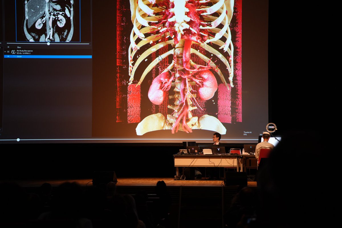 viewtify's tweet photo. Viewtify on stage at SIGGRAPH Asia 2024 Real-Time Live! The presenter is @HirofumiSeo , the CEO and the developer of Viewtify. https://t.co/2EVtdkQMhj