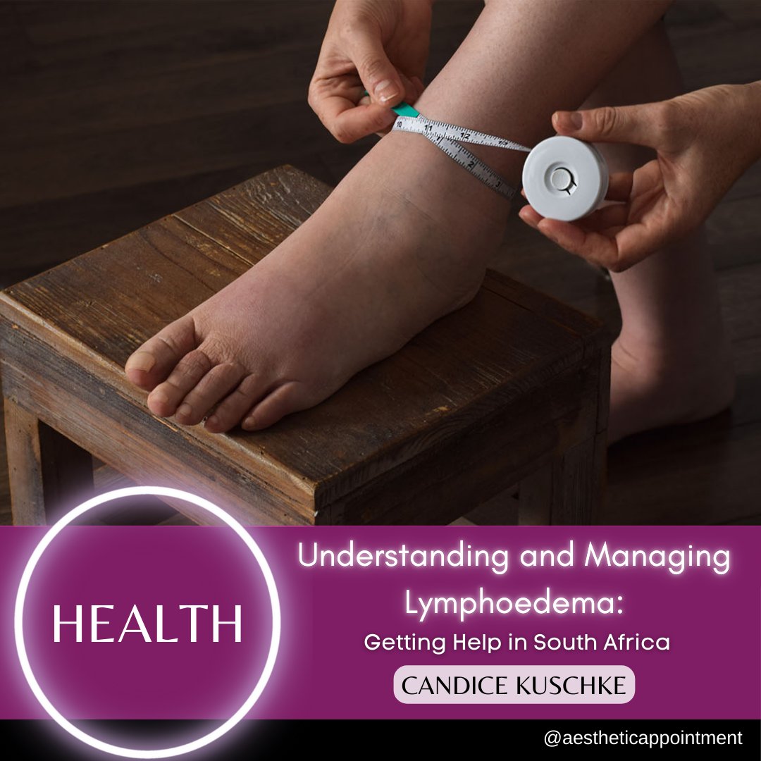 aestheticappsa's tweet image. Living with lymphoedema? Early diagnosis and consistent care are crucial for managing symptoms aestheticappointment.co.za/2024/12/unders…

#lymphoedema #lymphedema #oncology #lymphatics #LOASA #cancerrehabilitation #physiotherapy #decongestivetherapy #varicoseveins #lymphnodes #lymphaticmassage