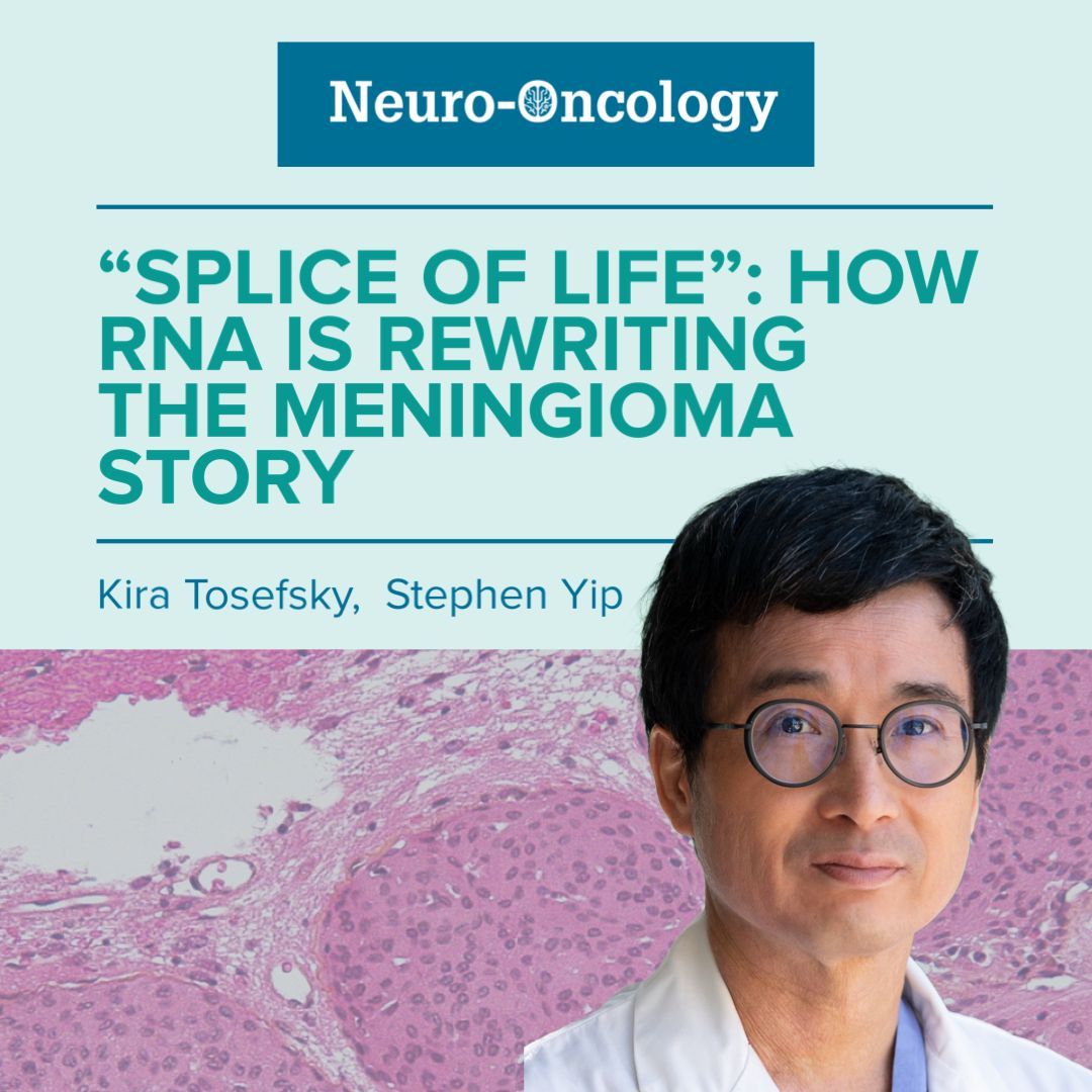 Read #ICOM member Stephen Yip’s recent article “Splice of Life”: How #RNA is Rewriting the #Meningioma Story in #NeuroOncology: 

buff.ly/41gMrCw