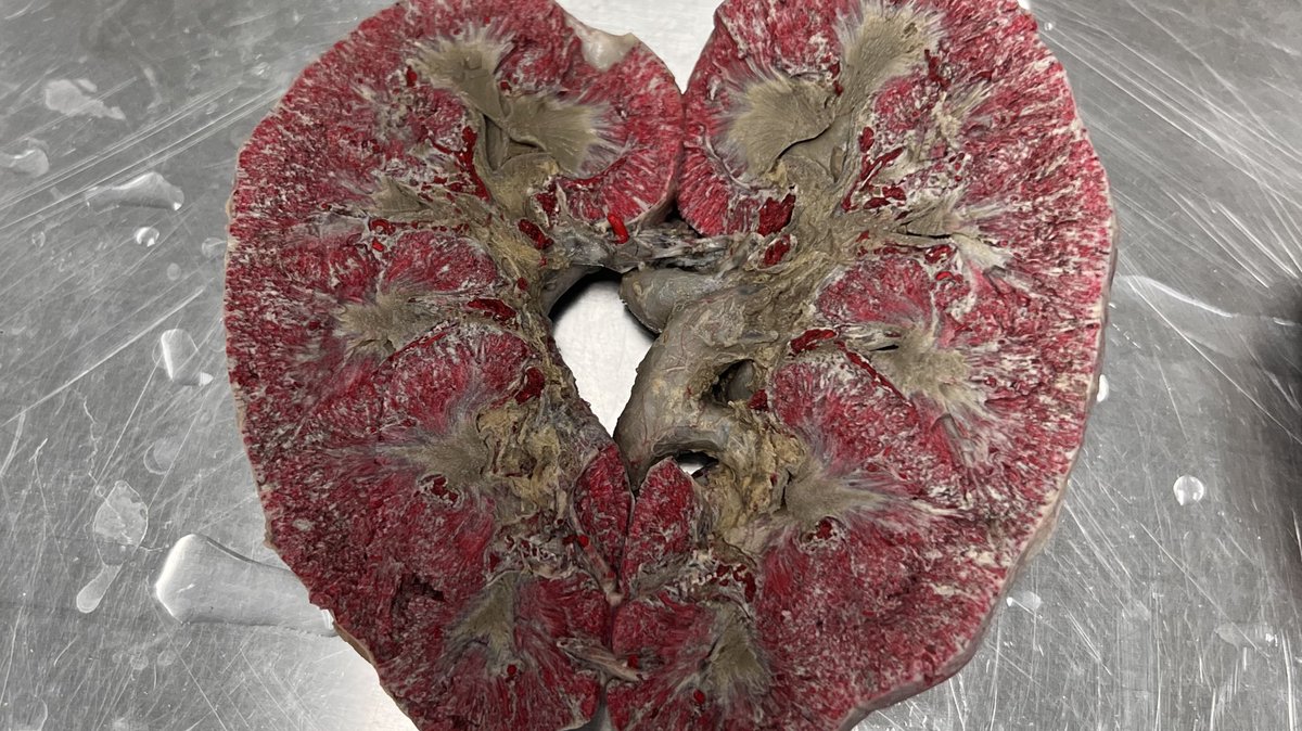 sirmohammd's tweet photo. Urinary system ✔️

محتواه جميل وبسيط، مشكلته الوقت ويبدو أنها مشكلة بتتكرر كثير في الموديولات القادمة 😅 https://t.co/JgO82L6DzC