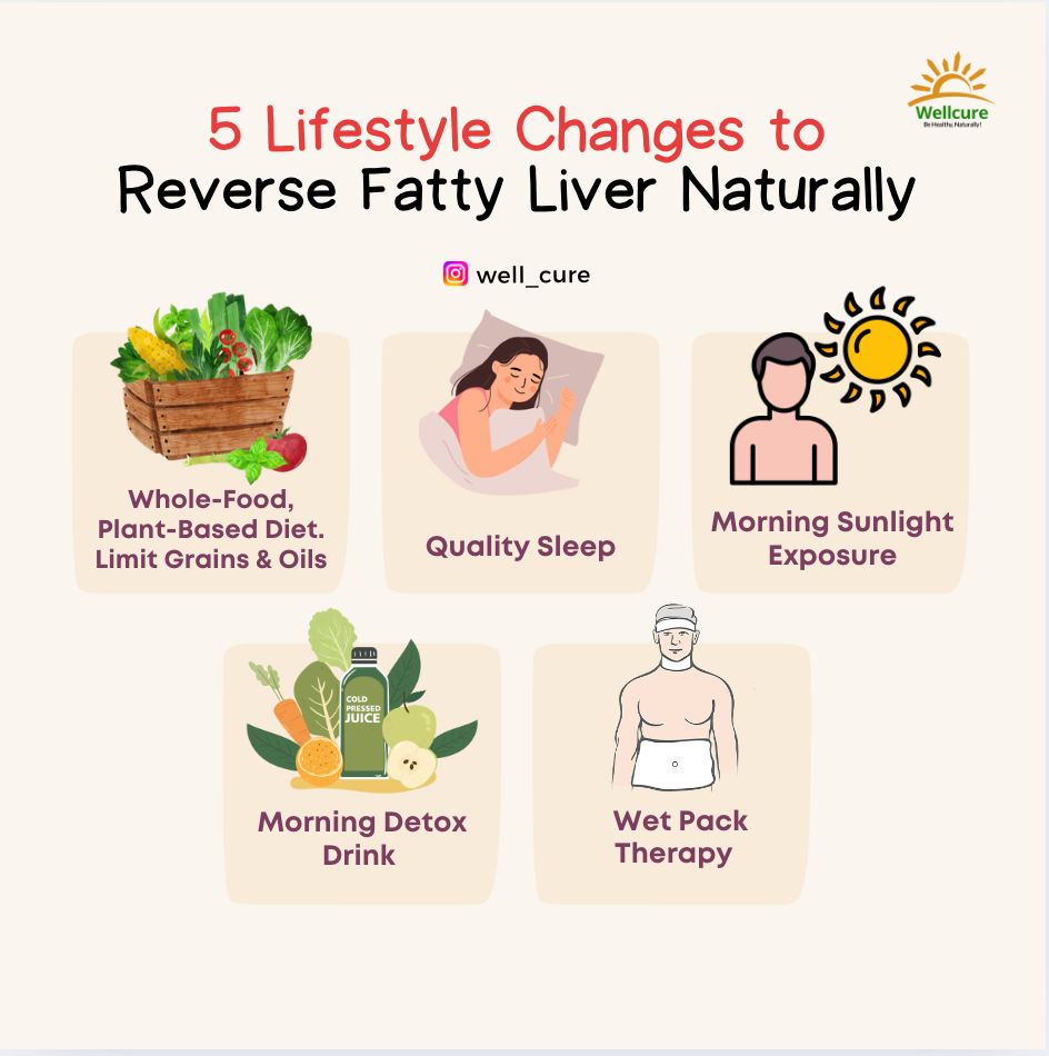 well_cure's tweet photo. Fatty liver disease is not just about alcohol! Non-alcoholic fatty liver affects 1 in 3 adults worldwide. If left unattended, it can lead to further liver damage, cirrhosis, and even liver cancer. 

🙌 Good news is that it is reversible! #fattyliver #liver #healthcare #Healing https://t.co/tex1V3yPdg