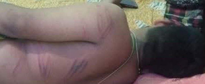 बिहार पुलिस के कार्य देखिए। छात्रों को मारकर हाथ,पैर तोड़ दिया गया है।
#no_normalization_in_bpsc #JAWAB_DO_BPSC #One_Shift_One_Paper #BPSC #bpsc70th #BPSC_70th #Bihar #ReOpen_70thBPSC_Form

<a href="/yadavtejashwi/">Tejashwi Yadav</a> <a href="/RJDforIndia/">Rashtriya Janata Dal</a> <a href="/Jduonline/">Janata Dal (United)</a> <a href="/NitishKumar/">Nitish Kumar</a> <a href="/officecmbihar/">CMO Bihar</a> <a href="/RJD_BiharState/">बिहार राजद</a>