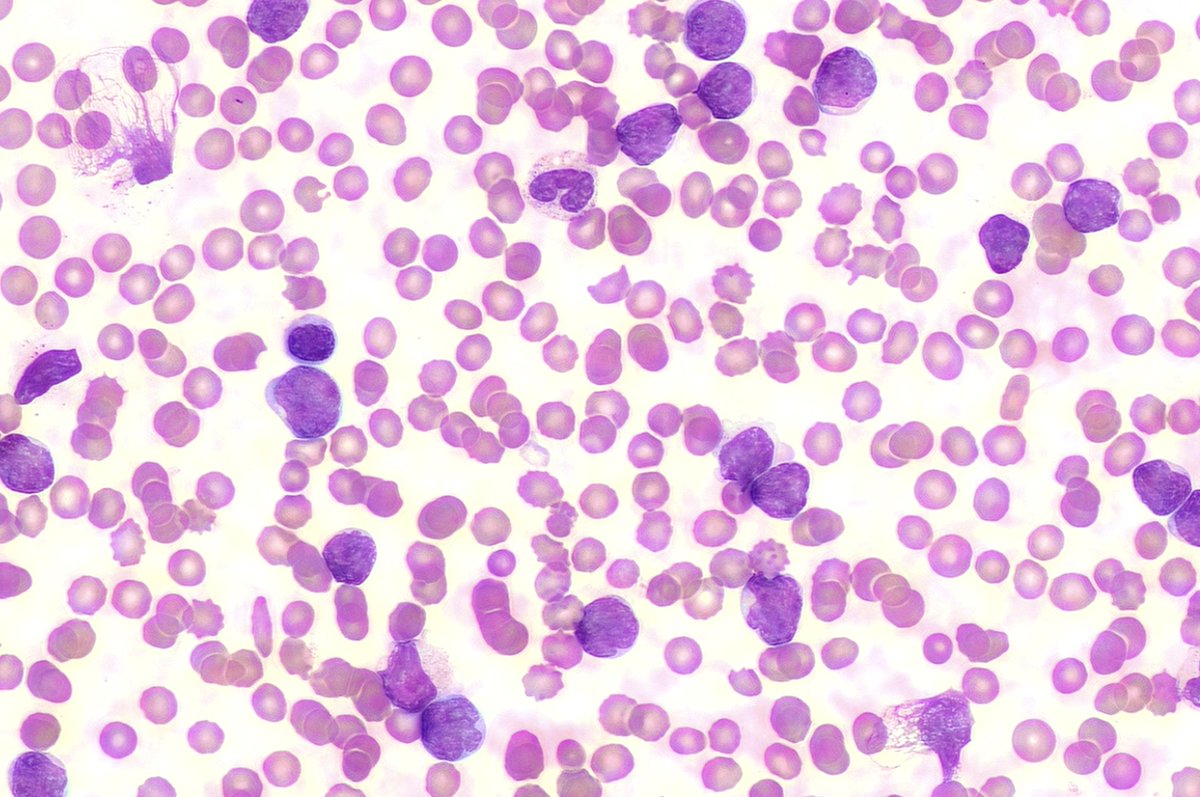 Bread & Butter Haematology tweet media