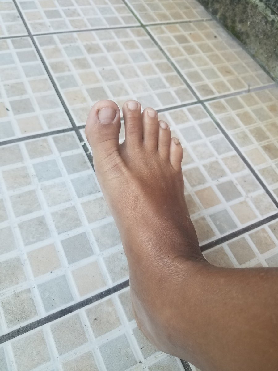 mileya394's tweet photo. @elcipitio503 Los pies de una mujer que trabaja en el campo https://t.co/yUNpakFeyB