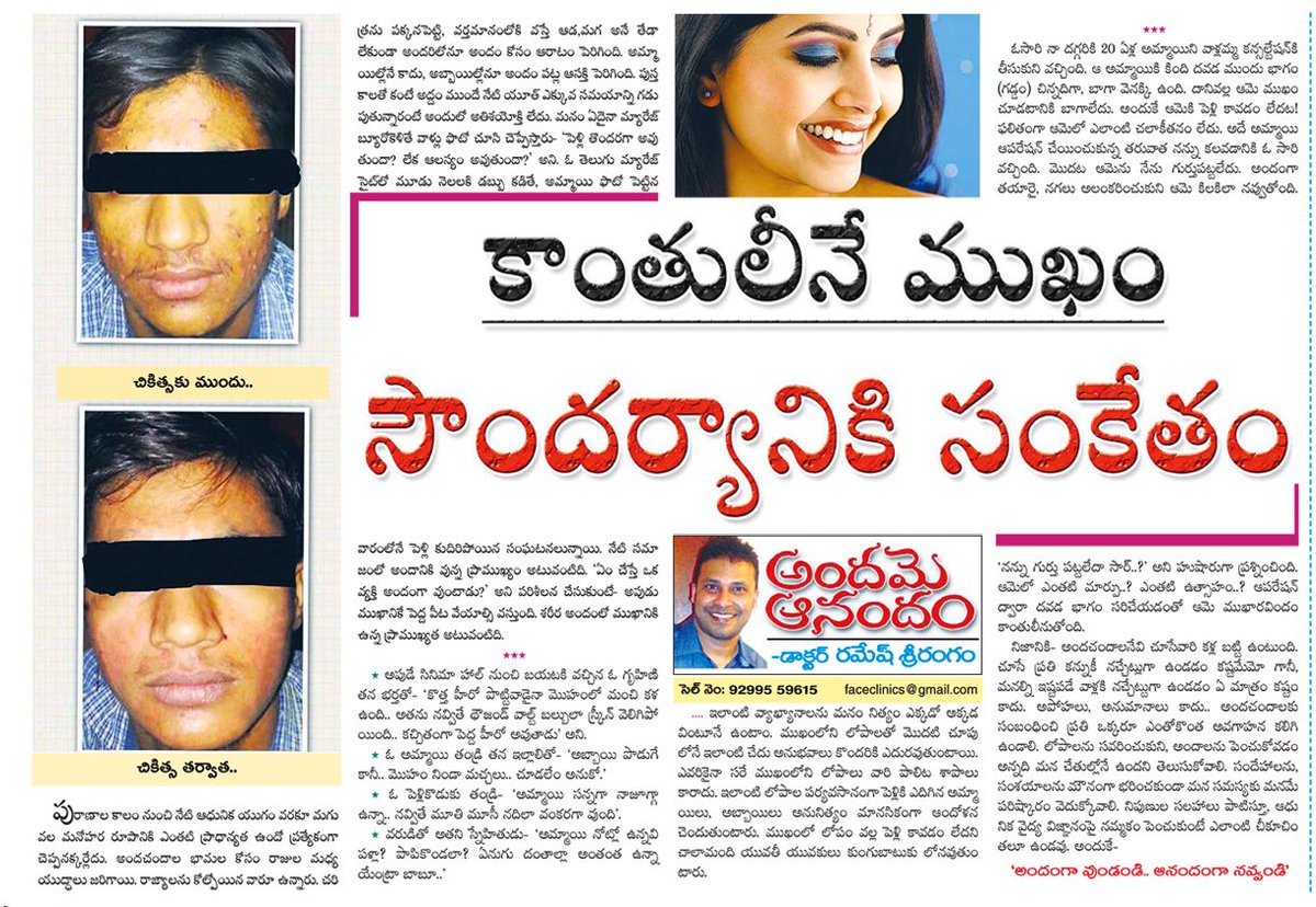 awakenthegaint's tweet image. My news paper publication #pimples